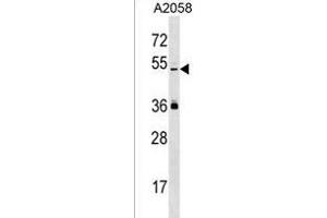 PREL Antibody (Center) (ABIN1537984 and ABIN2850411) western blot analysis in  cell line lysates (35 μg/lane). (PRAMEL Antikörper  (AA 184-211))