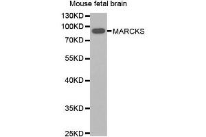 Western blot analysis of extracts of Mouse fetal brain, using MARCKS antibody. (MARCKS Antikörper)