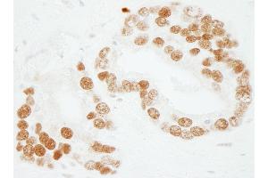 Immunohistochemistry (IHC) image for anti-Activated RNA Polymerase II Transcriptional Coactivator p15 (SUB1) (AA 25-75) antibody (ABIN7453754)