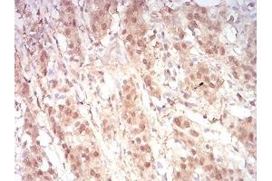 Immunohistochemistry (IHC) image for anti-RAN, Member RAS Oncogene Family (RAN) (AA 1-216) antibody (ABIN5876159) (RAN Antikörper  (AA 1-216))