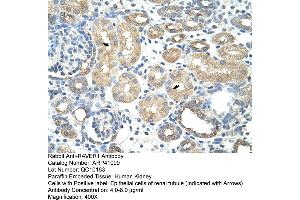 Rabbit Anti-RAVER1Antibody  Paraffin Embedded Tissue: Human Kidney Cellular Data: Epithelial cells of renal tubule Antibody Concentration: 4. (RAVER1 Antikörper  (N-Term))
