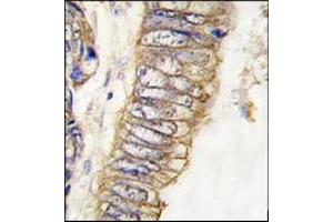 Immunohistochemistry (IHC) image for anti-Met Proto-Oncogene (MET) (Catalytic Domain) antibody (ABIN356339)