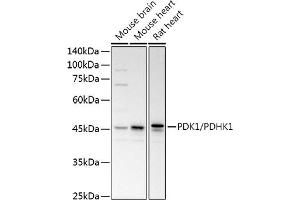 Western blot analysis of extracts of various cell lines, using PDK1/PDHK1 antibody (ABIN3015351, ABIN3015352, ABIN1681301, ABIN5663787 and ABIN6214001) at 1:1000 dilution. (PDPK1 Antikörper  (AA 1-150))