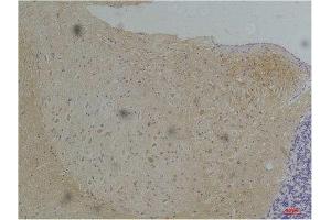 Immunohistochemistry (IHC) analysis of paraffin-embedded Mouse Brain Tissue using KV1. (Kv1.1 Potassium Channel Antikörper)