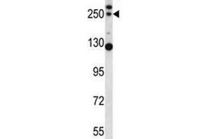 C4B antibody western blot analysis in mouse lung tissue lysate (C4B Antikörper  (AA 655-684))