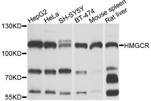 Western blot analysis of extracts of various cell lines, using HMGCR antibody (ABIN5970803) at 1/1000 dilution.