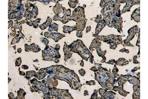 Immunohistochemistry (IHC) image for anti-Ionized Calcium-binding Adapter Molecule 1 (IBA1) (C-Term) antibody (ABIN184738)