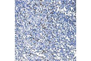 IHC analysis of RAD18 using anti-RAD18 antibody (ABIN7599364). (RAD18 Antikörper  (AA 1-408))