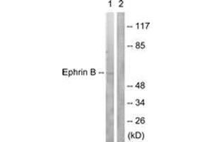 Western blot analysis of extracts from 293 cells, treated with EGF 200ng/ml 5', using EFNB1/2 (Ab-330) Antibody. (EFNB1/2 (AA 284-333) Antikörper)