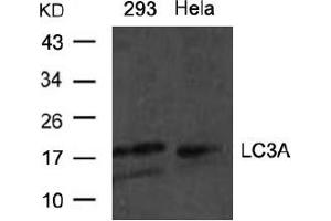 Image no. 1 for anti-Microtubule-Associated Protein 1 Light Chain 3 alpha (MAP1LC3A) (N-Term) antibody (ABIN319368) (MAP1LC3A Antikörper  (N-Term))