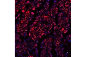 IF analysis of TRMT6 using anti-TRMT6 antibody (ABIN7602138).