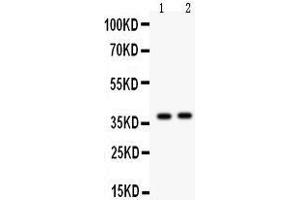 Anti- Calretinin Picoband antibody, Western blotting All lanes: Anti Calretinin  at 0. (Calretinin Antikörper  (C-Term))
