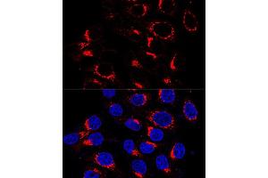 Immunofluorescence analysis of HeLa cells using USO1 antibody (ABIN7271235) at dilution of 1:200 (60x lens). (USO1 Antikörper  (AA 663-962))