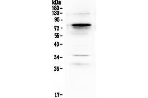 Western blot analysis of Complement C9 using anti-Complement C9 antibody . (C9 Antikörper  (AA 289-515))