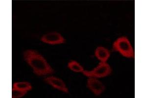ABIN6267258 staining BT-20 cells by ICC/IF.