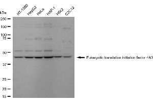 anti-Eukaryotic Translation Initiation Factor 4A3 (EIF4A3) antibody