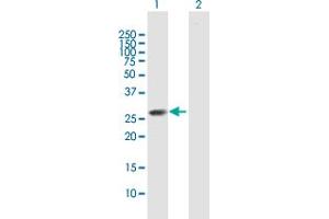 Western Blot analysis of CLTB expression in transfected 293T cell line by CLTB MaxPab polyclonal antibody. (CLTB Antikörper  (AA 1-211))
