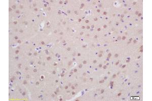 Formalin-fixed and paraffin embedded rat brain labeled with Anti-Prox1 Polyclonal Antibody, Unconjugated (ABIN680503) at 1:200 followed by conjugation to the secondary antibody and DAB staining (PROX1 Antikörper  (AA 151-250))
