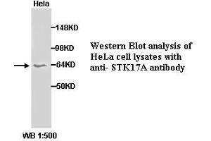 Image no. 1 for anti-serine/threonine Kinase 17a (STK17A) (C-Term) antibody (ABIN790926) (STK17A Antikörper  (C-Term))