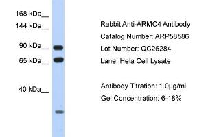 Western Blotting (WB) image for anti-Armadillo Repeat Containing 4 (ARMC4) (N-Term) antibody (ABIN2787749) (ARMC4 Antikörper  (N-Term))