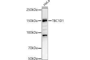 Western blot analysis of extracts of HeLa cells, using TBC1D1 antibody (ABIN6129487, ABIN6148878, ABIN6148879 and ABIN6225024) at 1:1000 dilution. (TBC1D1 Antikörper  (AA 520-710))