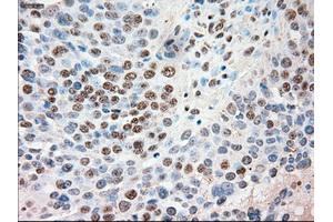 Immunohistochemical staining of paraffin-embedded Kidney tissue using anti-SIGLEC9mouse monoclonal antibody. (SIGLEC9 Antikörper)