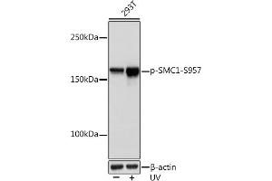 Western blot analysis of extracts of 293T cells, using Phospho-SMC1-S957 Rabbit mAb (ABIN7270613) at 1:1000 dilution. (SMC1A Antikörper  (pSer957))