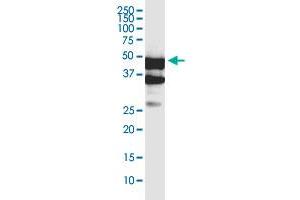 SERTAD4 monoclonal antibody (M02), clone 3G11. (SERTAD4 Antikörper  (AA 1-356))