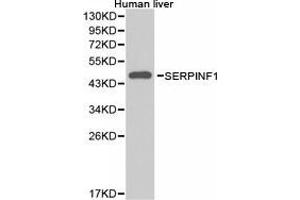 Western Blotting (WB) image for anti-serpin Peptidase Inhibitor, Clade F (Alpha-2 Antiplasmin, Pigment Epithelium Derived Factor), Member 1 (SERPINF1) antibody (ABIN1874740) (PEDF Antikörper)