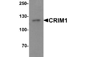 Western blot analysis of CRIM1 in Jurkat cell lysate with Crim1 antibody at 1 µg/mL. (CRIM1 Antikörper  (C-Term))