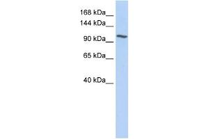 WB Suggested Anti-NNT Antibody Titration:  0. (NNT Antikörper  (N-Term))
