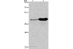 Western blot analysis of Mouse liver and brain tissue, using GLUL Polyclonal Antibody at dilution of 1:650 (GLUL Antikörper)