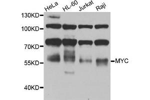 Western blot analysis of extracts of various cells, using MYC antibody. (c-MYC Antikörper)