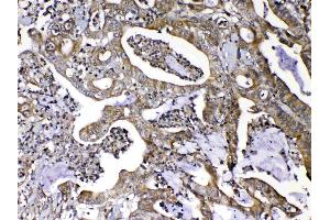 IHC analysis of MMP16 using anti-MMP16 antibody . (MMP16 Antikörper  (AA 120-296))