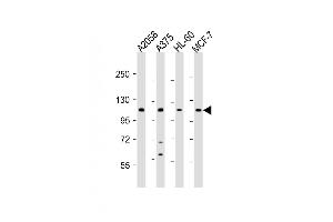 All lanes : Anti-COL17A1 Antibody (Center) at 1:2000 dilution Lane 1:  whole cell lysate Lane 2:  whole cell lysate Lane 3: HL-60 whole cell lysate Lane 4: MCF-7 whole cell lysate Lysates/proteins at 20 μg per lane.