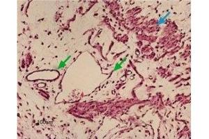 Expression of Kir6. (Potassium Inwardly-Rectifying Channel, Subfamily J, Member 8 (KCNJ8) Peptid)