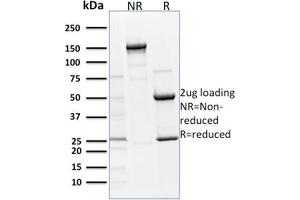 SDS-PAGE Analysis Purified p63 Mouse Monoclonal Antibody (TP63/1786). (p63 Antikörper  (AA 3-106))