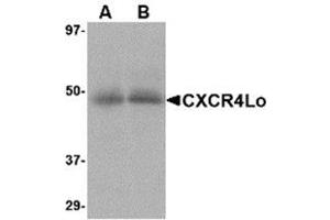 Western blot analysis of CXCR4 in (A) human spleen and (B) human thymus tissue lysate with AP30268PU-N CXCR4-Lo antibody at 10 μg/ml. (CXCR4 Antikörper  (Isoform A, N-Term))