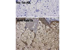Immunohistochemistry (IHC) image for anti-RAB1B, Member RAS Oncogene Family (RAB1B) (C-Term) antibody (ABIN6254186) (RAB1B Antikörper  (C-Term))