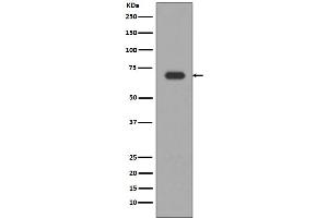 Western blot analysis of Alas1 expression in HepG2 cell lysate. (Rekombinanter ALAS1 Antikörper)