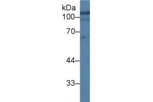 Detection of HEXb in Human Hela cell lysate using Polyclonal Antibody to Hexosaminidase B Beta (HEXb)