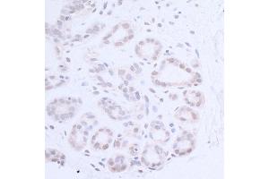 anti-Xeroderma Pigmentosum, Complementation Group A (XPA) (AA 1-50) antibody