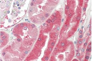 Immunohistochemistry (IHC) image for anti-Von Hippel-Lindau Tumor Suppressor, E3 Ubiquitin Protein Ligase (VHL) (Internal Region) antibody (ABIN185675)