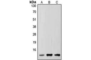 Western blot analysis of SUMO2/3 expression in HepG2 (A), mouse brain (B), rat brain (C) whole cell lysates. (SUMO2/3 Antikörper  (Center))