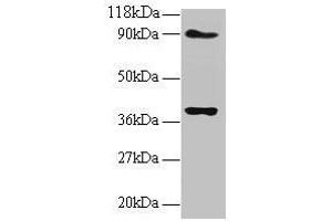Western Blotting (WB) image for anti-NADH Dehydrogenase (Ubiquinone) Fe-S Protein 5, 15kDa (NADH-Coenzyme Q Reductase) (NDUFS5) (AA 2-106) antibody (ABIN7160963)