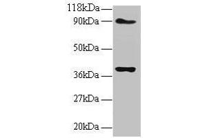 Western blot All lanes: NDUFS5 antibody at 2 μg/mL Lane 1: EC109 whole cell lysate Lane 2: 293T whole cell lysate Secondary Goat polyclonal to rabbit IgG at 1/15000 dilution Predicted band size: 13 kDa Observed band size: 40 kDa (NDUFS5 Antikörper  (AA 2-106))