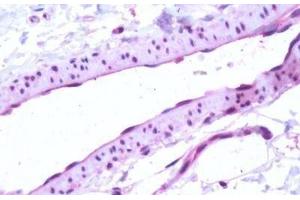 Human, Vascular Endothelium: Formalin-Fixed Paraffin-Embedded (FFPE) (S1PR1 Antikörper  (Cytoplasmic Domain))