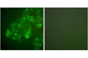 Immunofluorescence analysis of A549 cells, using Connexin 43 Antibody. (Connexin 43/GJA1 Antikörper  (AA 333-382))