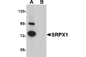 Western Blotting (WB) image for anti-Sushi-Repeat Containing Protein, X-Linked (SRPX) (N-Term) antibody (ABIN1031585)