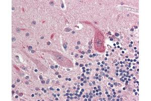 Anti-OSMR antibody IHC staining of human brain, cerebellum. (Oncostatin M Receptor Antikörper  (AA 612-661))